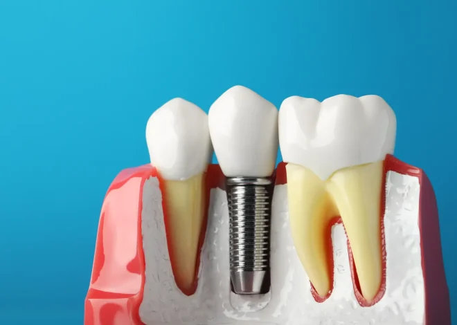 Dentysta Warszawa